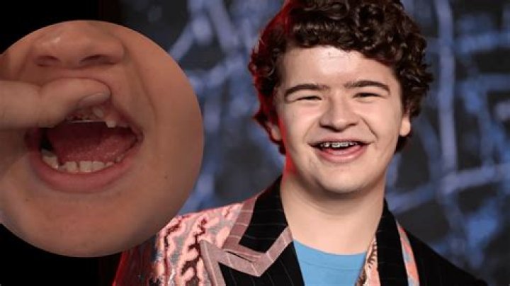 Unveiling The Intriguing Medical Journey Of Gaten Matarazzo