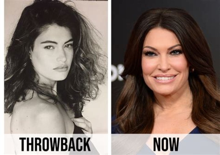 Unveiling The Pre-Plastic Surgery Era