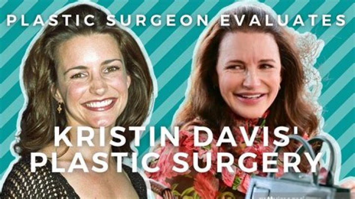 Unveiling Kristen Davis' Transformation: Surgical Enhancements Revealed